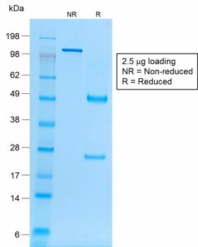EPCAM Antibody - SDS-PAGE Analysis Purified EpCAM Mouse Recombinant Monoclonal Antibody (rVU-1D9). Confirmation of Purity and Integrity of Antibody.