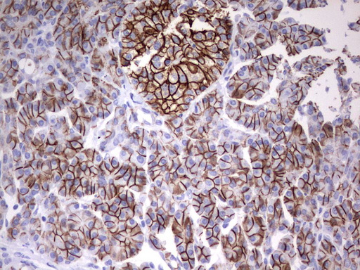 EPCAM Antibody - Immunohistochemical staining of paraffin-embedded Human pancreas tissue using anti-EPCAM mouse monoclonal antibody.  heat-induced epitope retrieval by 10mM citric buffer, pH6.0, 120C for 3min)