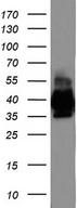 EPCAM Antibody - Western blot analysis of LOVO cell lysate. (35ug) by using anti-EPCAM monoclonal antibody.