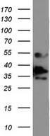 EPCAM Antibody - Western blot analysis of COLO205 cell lysate. (35ug) by using anti-EPCAM monoclonal antibody.