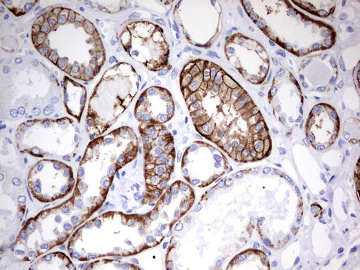 EPCAM Antibody - Immunohistochemical staining of paraffin-embedded Human Kidney tissue using anti-EPCAM mouse monoclonal antibody.  heat-induced epitope retrieval by 10mM citric buffer, pH6.0, 120C for 3min)