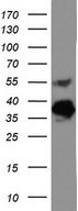 EPCAM Antibody - Western blot analysis of KM12 cell lysate. (35ug) by using anti-EPCAM monoclonal antibody.