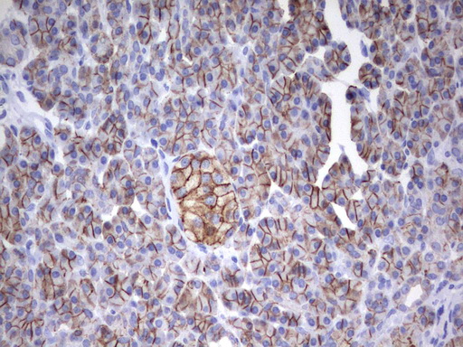 EPCAM Antibody - Immunohistochemical staining of paraffin-embedded Human pancreas tissue using anti-EPCAM mouse monoclonal antibody.  heat-induced epitope retrieval by 10mM citric buffer, pH6.0, 120C for 3min)
