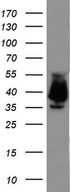 EPCAM Antibody - Western blot analysis of LOVO cell lysate. (35ug) by using anti-EPCAM monoclonal antibody.