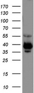 EPCAM Antibody - Western blot analysis of COLO205 cell lysate. (35ug) by using anti-EPCAM monoclonal antibody.
