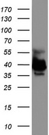 EPCAM Antibody - Western blot analysis of HEK293 cell lysate. (35ug) by using anti-EPCAM monoclonal antibody.