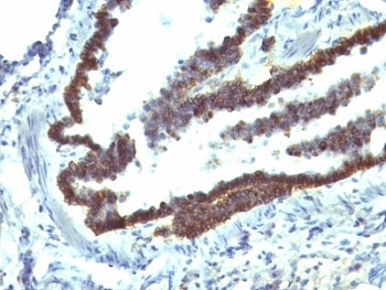 EPCAM Antibody - Formalin-fixed, paraffin-embedded rat lung stained with EpCAM antibody (EGP40/1110).  This image was taken for the unmodified form of this product. Other forms have not been tested.