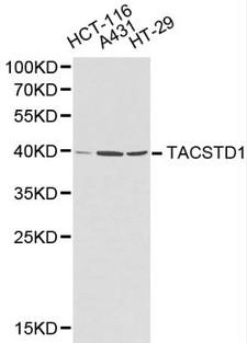 EPCAM Antibody - Western blot of TACSTD1 pAb in extracts from HCY-116, A431 and HT-29 cells.