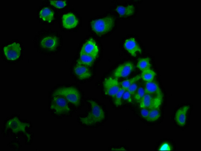 EPCAM Antibody - Immunofluorescence staining of MCF-7 cells at a dilution of 1:133, counter-stained with DAPI. The cells were fixed in 4% formaldehyde, permeabilized using 0.2% Triton X-100 and blocked in 10% normal Goat Serum. The cells were then incubated with the antibody overnight at 4°C.The secondary antibody was Alexa Fluor 488-congugated AffiniPure Goat Anti-Rabbit IgG (H+L) .