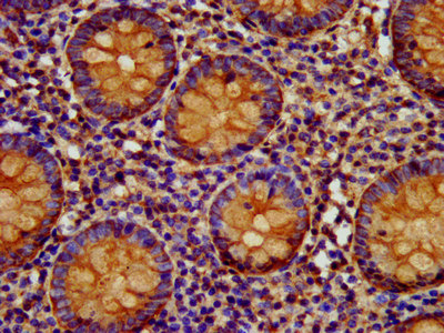EPCAM Antibody - Immunohistochemistry image at a dilution of 1:400 and staining in paraffin-embedded human appendix tissue performed on a Leica BondTM system. After dewaxing and hydration, antigen retrieval was mediated by high pressure in a citrate buffer (pH 6.0) . Section was blocked with 10% normal goat serum 30min at RT. Then primary antibody (1% BSA) was incubated at 4 °C overnight. The primary is detected by a biotinylated secondary antibody and visualized using an HRP conjugated SP system.