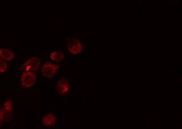 EPCAM Antibody - Staining HeLa cells by IF/ICC. The samples were fixed with PFA and permeabilized in 0.1% Triton X-100, then blocked in 10% serum for 45 min at 25°C. The primary antibody was diluted at 1:200 and incubated with the sample for 1 hour at 37°C. An Alexa Fluor 594 conjugated goat anti-rabbit IgG (H+L) Ab, diluted at 1/600, was used as the secondary antibody.