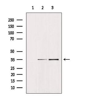 EPCAM Antibody - Western blot analysis of extracts of various samples using TACSTD1 antibody. Lane 1: HeLa treated with blocking peptide; Lane 2: HeLa; Lane 3: 293;