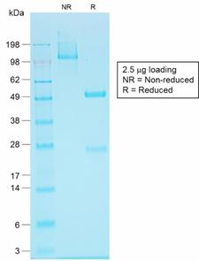 EPCAM Antibody - SDS-PAGE Analysis Purified EpCAM Rabbit Recombinant Monoclonal Antibody (EGP40/1555R). Confirmation of Purity and Integrity of Antibody.