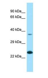 EPDR / EPDR1 Antibody - EPDR / EPDR1 antibody Western Blot of Jurkat. Antibody dilution: 1 ug/ml.  This image was taken for the unconjugated form of this product. Other forms have not been tested.