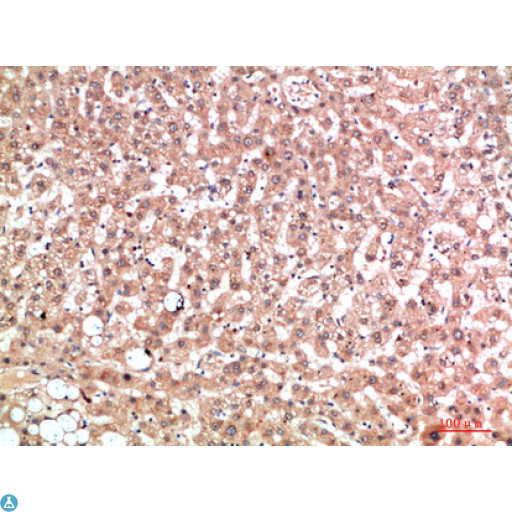 EPG5 / KIAA1632 Antibody - Immunohistochemical analysis of paraffin-embedded human-liver, antibody was diluted at 1:200.