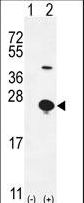 EPGN / Epigen Antibody - Western blot of EPGN (arrow) using rabbit polyclonal EPGN Antibody. 293 cell lysates (2 ug/lane) either nontransfected (Lane 1) or transiently transfected (Lane 2) with the EPGN gene.