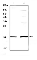 EPGN / Epigen Antibody - Western blot analysis of Epigen using anti-Epigen antibody. Electrophoresis was performed on a 5-20% SDS-PAGE gel at 70V (Stacking gel) / 90V (Resolving gel) for 2-3 hours. The sample well of each lane was loaded with 50ug of sample under reducing conditions. Lane 1: human A431 whole Cell lysate,Lane 2: rat PC-12 whole Cell lysate. After Electrophoresis, proteins were transferred to a Nitrocellulose membrane at 150mA for 50-90 minutes. Blocked the membrane with 5% Non-fat Milk/ TBS for 1.5 hour at RT. The membrane was incubated with rabbit anti-Epigen antigen affinity purified polyclonal antibody at 0.5 µg/mL overnight at 4°C, then washed with TBS-0.1% Tween 3 times with 5 minutes each and probed with a goat anti-rabbit IgG-HRP secondary antibody at a dilution of 1:10000 for 1.5 hour at RT. The signal is developed using an Enhanced Chemiluminescent detection (ECL) kit with Tanon 5200 system. A specific band was detected for Epigen at approximately 17KD. The expected band size for Epigen is at 17KD.