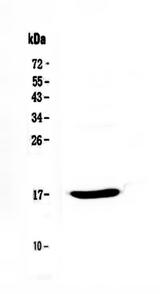 EPGN / Epigen Antibody - Western blot analysis of Epigen using anti-Epigen antibody. Electrophoresis was performed on a 5-20% SDS-PAGE gel at 70V (Stacking gel) / 90V (Resolving gel) for 2-3 hours. The sample well of each lane was loaded with 50ug of sample under reducing conditions. Lane 1: rat PC-12 whole Cell lysate. After Electrophoresis, proteins were transferred to a Nitrocellulose membrane at 150mA for 50-90 minutes. Blocked the membrane with 5% Non-fat Milk/ TBS for 1.5 hour at RT. The membrane was incubated with rabbit anti-Epigen antigen affinity purified polyclonal antibody at 0.5 µg/mL overnight at 4°C, then washed with TBS-0.1% Tween 3 times with 5 minutes each and probed with a goat anti-rabbit IgG-HRP secondary antibody at a dilution of 1:10000 for 1.5 hour at RT. The signal is developed using an Enhanced Chemiluminescent detection (ECL) kit with Tanon 5200 system. A specific band was detected for Epigen at approximately 17KD. The expected band size for Epigen is at 17KD.