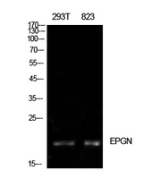 EPGN / Epigen Antibody - Western Blot analysis of extracts from 293T, 823 cells using EPGN Antibody.