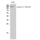 EPH Receptor A2+A3+A4 Antibody - Western blot of Phospho-EphA2/3/4 (Y588/596) antibody