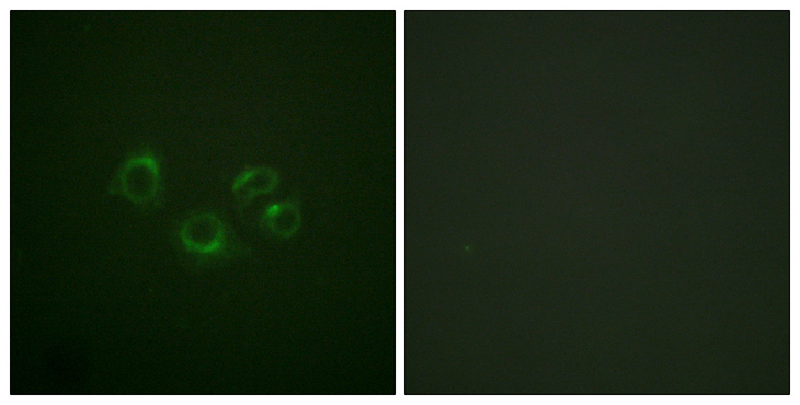 EPH Receptor A2+A3+A4 Antibody - Immunofluorescence analysis of A549 cells, using EPHA2/3/4 Antibody. The picture on the right is blocked with the synthesized peptide.