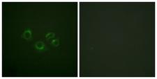EPH Receptor A2+A3+A4 Antibody - Immunofluorescence analysis of A549 cells, using EPHA2/3/4 Antibody. The picture on the right is blocked with the synthesized peptide.