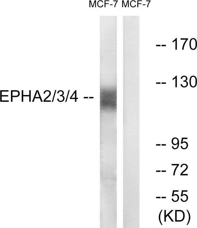 EPH Receptor A2+A3+A4 Antibody - Western blot analysis of lysates from MCF-7 cells, using EPHA2/3/4 Antibody. The lane on the right is blocked with the synthesized peptide.