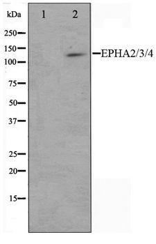 EPH Receptor A2+A3+A4 Antibody - Western blot of HepG2 cell lysate using EPHA2/3/4 Antibody