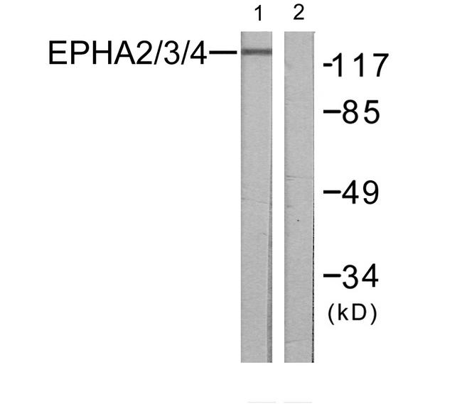EPH Receptor A2+A3+A4 Antibody - Western blot analysis of extracts from NIH/3T3 cells, using EPHA2/3/4 (Ab-588/596) antibody.