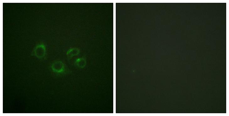 EPH Receptor A2+A3+A4 Antibody - Peptide - + Immunofluorescence analysis of A549 cells, using EPHA2/3/4 (Ab-588/596) antibody.