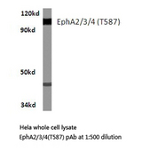 EPH Receptor A2+A3+A4 Antibody - Western blot of EphA2/3/4 (T587) pAb in extracts from HeLa cells.