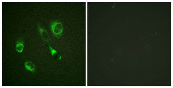 EPH Receptor A2+A3 Antibody - Immunofluorescence analysis of HeLa cells, using EPHA2/3 (Phospho-Tyr588/596) Antibody. The picture on the right is blocked with the phospho peptide.