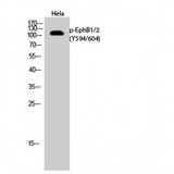 EPH Receptor B1+B2 Antibody - Western blot of Phospho-EphB1/2 (Y594/604) antibody
