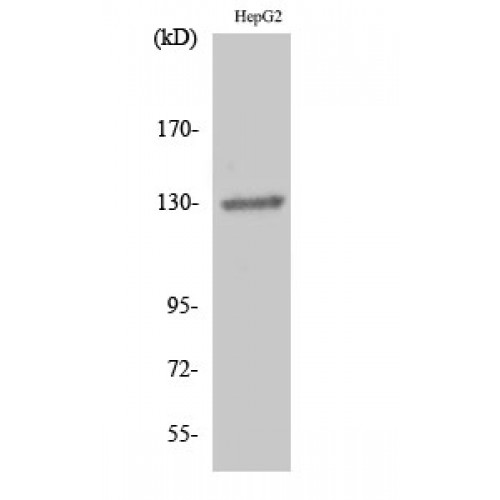 EPH Receptor B1+B2 Antibody - Western blot of EphB1/2 antibody