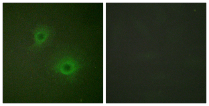 EPH Receptor B1+B2 Antibody - Immunofluorescence analysis of HUVEC cells, using EPHB1/2 Antibody. The picture on the right is blocked with the synthesized peptide.