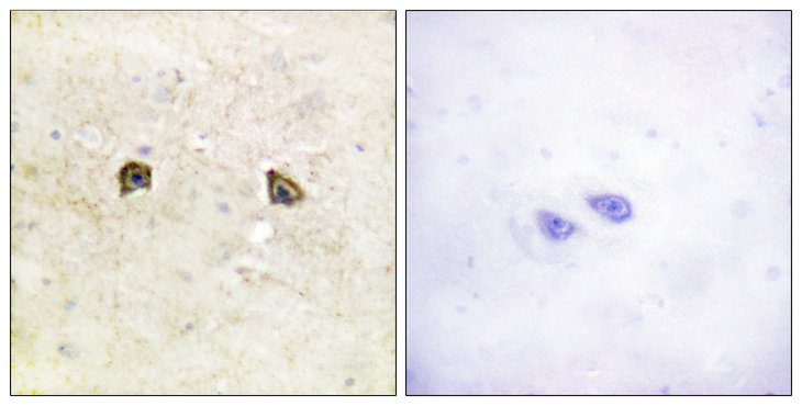 EPH Receptor B1+B2 Antibody - Immunohistochemistry analysis of paraffin-embedded human brain tissue, using EPHB1/2 Antibody. The picture on the right is blocked with the synthesized peptide.