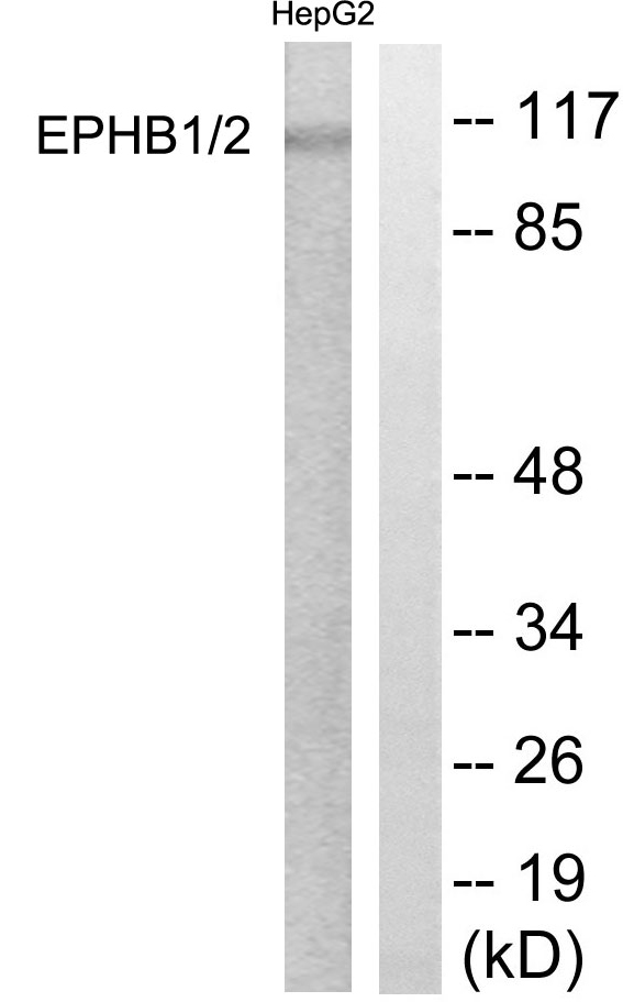 EPH Receptor B1+B2 Antibody - Western blot analysis of lysates from HepG2 cells, using EPHB1/2 Antibody. The lane on the right is blocked with the synthesized peptide.