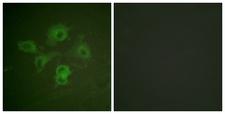 EPH Receptor B1+B2 Antibody - Immunofluorescence analysis of HUVEC cells, using EPHB1/2 (Phospho-Tyr594/604) Antibody. The picture on the right is blocked with the phospho peptide.