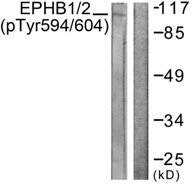 EPH Receptor B1+B2 Antibody - Western blot analysis of lysates from HepG2 cells, using EPHB1/2 (Phospho-Tyr594/604) Antibody. The lane on the right is blocked with the phospho peptide.