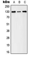 EPH Receptor B1+B2 Antibody - Western blot analysis of EPHB1/2 (pY594/604) expression in A431 (A); HeLa (B); NIH3T3 (C) whole cell lysates.