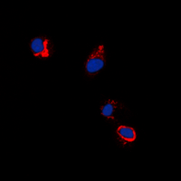 EPH Receptor B1+B2 Antibody - Immunofluorescent analysis of EPHB1/2 (pY594/604) staining in A431 cells. Formalin-fixed cells were permeabilized with 0.1% Triton X-100 in TBS for 5-10 minutes and blocked with 3% BSA-PBS for 30 minutes at room temperature. Cells were probed with the primary antibody in 3% BSA-PBS and incubated overnight at 4 C in a humidified chamber. Cells were washed with PBST and incubated with a DyLight 594-conjugated secondary antibody (red) in PBS at room temperature in the dark. DAPI was used to stain the cell nuclei (blue).