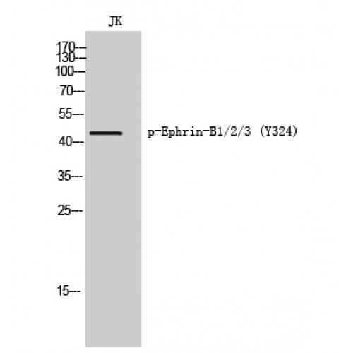 EPH Receptor B1+B2+B3 Antibody - Western blot of Phospho-Ephrin-B1/2/3 (Y324) antibody