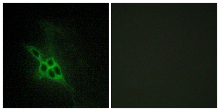 EPH Receptor B1+B2+B3 Antibody - Immunofluorescence analysis of NIH/3T3 cells, using EPHB1/2/3 Antibody. The picture on the right is blocked with the synthesized peptide.