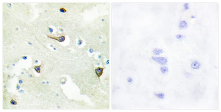 EPH Receptor B1+B2+B3 Antibody - Immunohistochemistry analysis of paraffin-embedded human brain tissue, using EPHB1/2/3 Antibody. The picture on the right is blocked with the synthesized peptide.