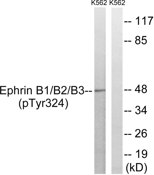 EPH Receptor B1+B2+B3 Antibody - Western blot analysis of lysates from K562 cells treated with serum 20% 15', using Ephrin B1/B2/B3 (Phospho-Tyr324) Antibody. The lane on the right is blocked with the phospho peptide.