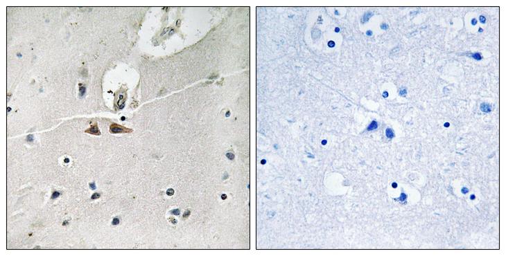 EPH Receptor B1+B2+B3 Antibody - P-peptide - + Immunohistochemistry analysis of paraffin-embedded human brain tissue using Ephrin B1/B2/B3 (Phospho-Tyr324) antibody.