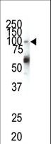 EPHA1 / EPH Receptor A1 Antibody - Western blot of anti-EphA1 N-term antibody in HeLa cell lysate. EphA1 (arrow) was detected using purified antibody. Secondary HRP-anti-rabbit was used for signal visualization with chemiluminescence.