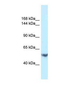 EPHA1 / EPH Receptor A1 Antibody - Western blot of Human PANC1. EPHA1 antibody dilution 1.0 ug/ml.  This image was taken for the unconjugated form of this product. Other forms have not been tested.