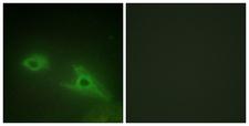 EPHA1 / EPH Receptor A1 Antibody - Immunofluorescence analysis of HeLa cells, using EPHA1 Antibody. The picture on the right is blocked with the synthesized peptide.