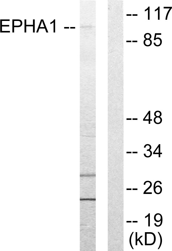 EPHA1 / EPH Receptor A1 Antibody - Western blot analysis of lysates from COLO205 cells, using EPHA1 Antibody. The lane on the right is blocked with the synthesized peptide.